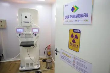 Fabio Rodrigues-Pozzebom/ Agência Brasil Brasília (DF) 23/10/2025 - Equipamento de mamografia da carreta de saúde da mulher do programa Agora Tem Especialistas no estacionamento do Hospital Regional de Ceilândia, cidade satélite de Brasília Foto: Fabio Rodrigues-Pozzebom/ Agência Brasil
