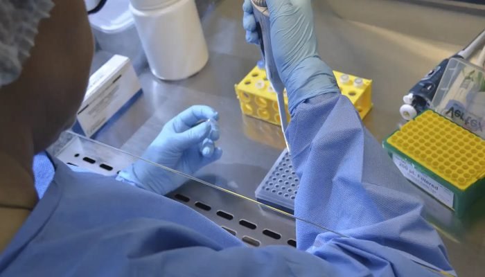 17_07_2020_covid_testes_exame.jpg © Robson Valverde / SES-SC