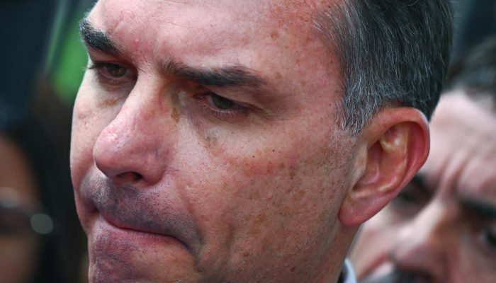 O senador Flávio Bolsonaro, após visita ao pai, Jair Bolsonaro. (Foto: André Borges / (EPA) EFE)